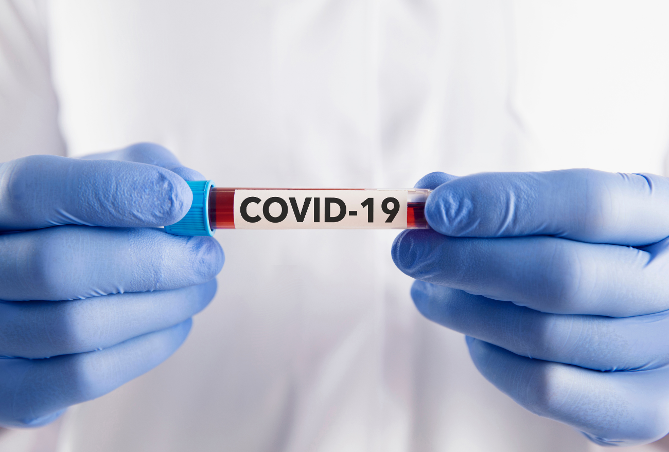 Xavantina registra cinco casos positivos para Covid-19